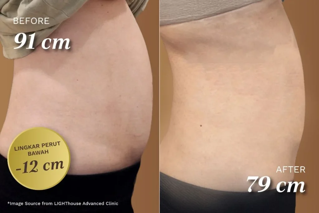 Mau Lemak Tubuh Hilang Secara Instan? #diULFRAaja